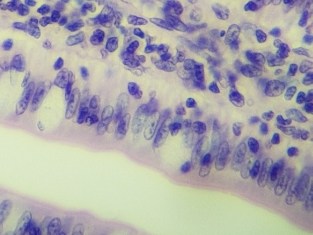 Simple Columnar Epithelium Slides - Simple Columnar Epithelium 17 400X